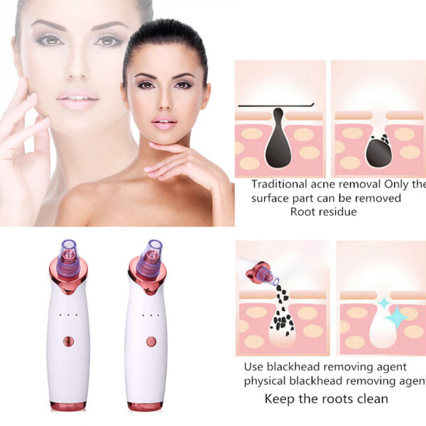 Blackhead Remover Instrument Black Dot Remover Acne Vacuum Suction Face Clean Black Head Pore Cleaning Beauty Skin Care Tool - Image 5